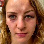 Margaux Pinot: ‘I thought I was dead,’ says French judoka