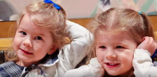 Pioneering treatment saves identical twins from rare pregnancy condition