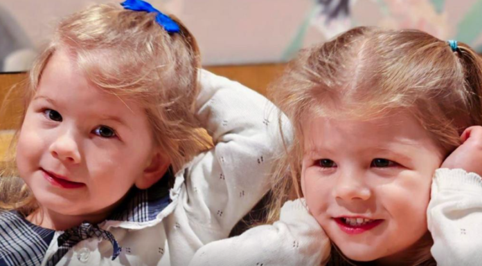 Pioneering treatment saves identical twins from rare pregnancy condition Pioneering treatment saves identical twins from rare pregnancy condition